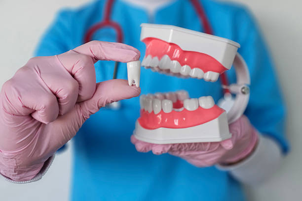 What Are Single-Tooth Dental Implants and How Do They Work?